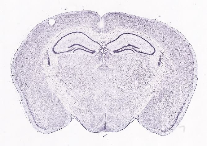 Allen ISH experiment 75773699, image 75665767 -- target region: ME (Median eminence)