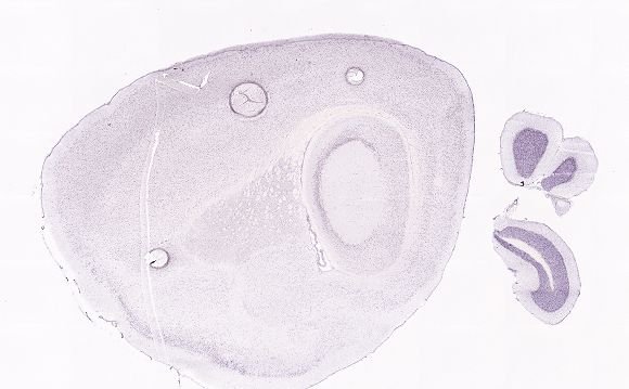 Allen ISH experiment 77800897, image 77779584 -- target region: RT (Reticular nucleus of the thalamus)