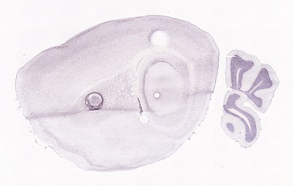 Allen ISH experiment 77800897, image 77779586 -- target region: RT (Reticular nucleus of the thalamus)