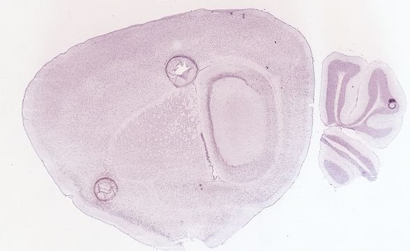 Allen ISH experiment 69258226, image 69149960 -- target region: MEPO (Median preoptic nucleus)