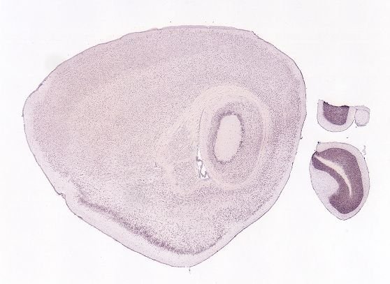 Allen ISH experiment 71210583, image 70939129 -- target region: RT (Reticular nucleus of the thalamus)