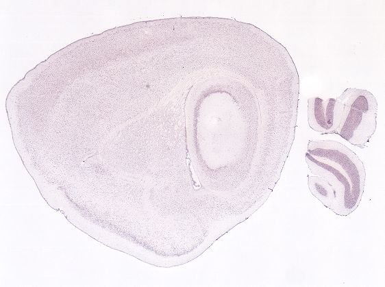 Allen ISH experiment 71210583, image 70939131 -- target region: RT (Reticular nucleus of the thalamus)