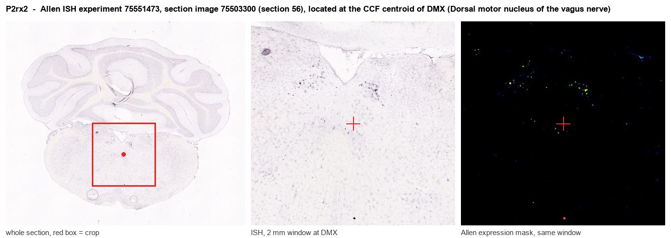 P2rx2 Allen ISH at the CCF centroid of DMX
