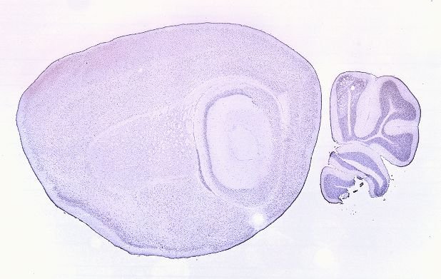 Allen ISH experiment 68668114, image 68352412 -- target region: PVT (Paraventricular nucleus of the thalamus)