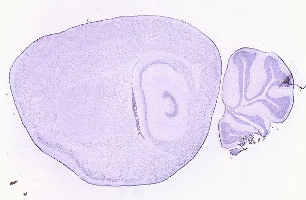 Allen ISH experiment 68668114, image 68352414 -- target region: PVT (Paraventricular nucleus of the thalamus)