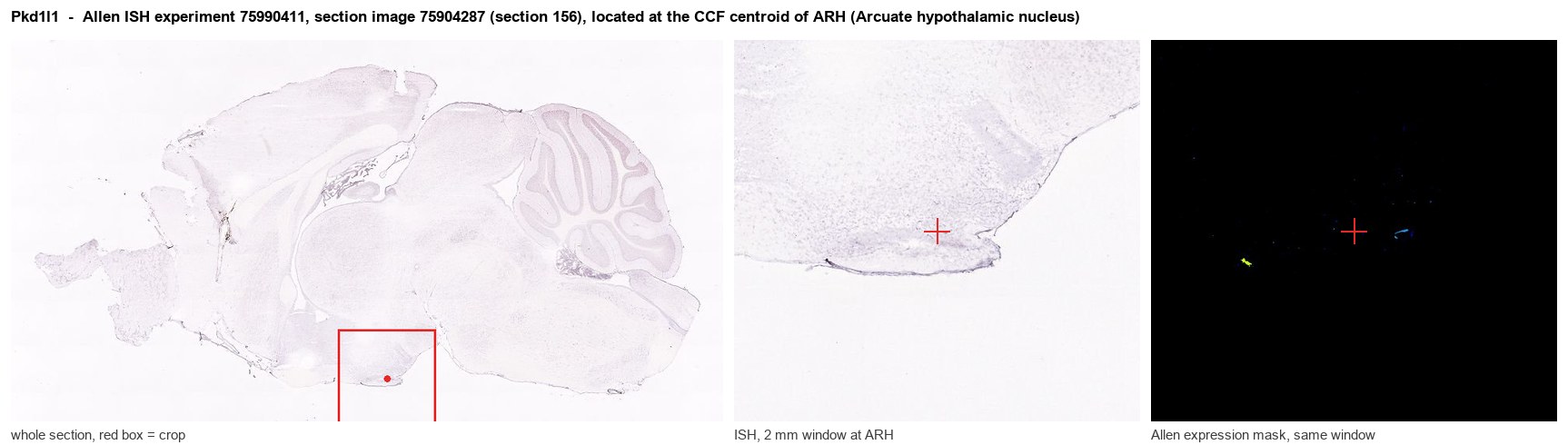 Pkd1l1 Allen ISH at the CCF centroid of ARH