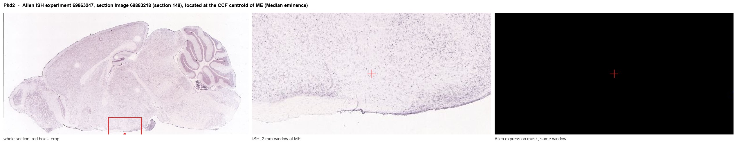 Pkd2 Allen ISH at the CCF centroid of ME