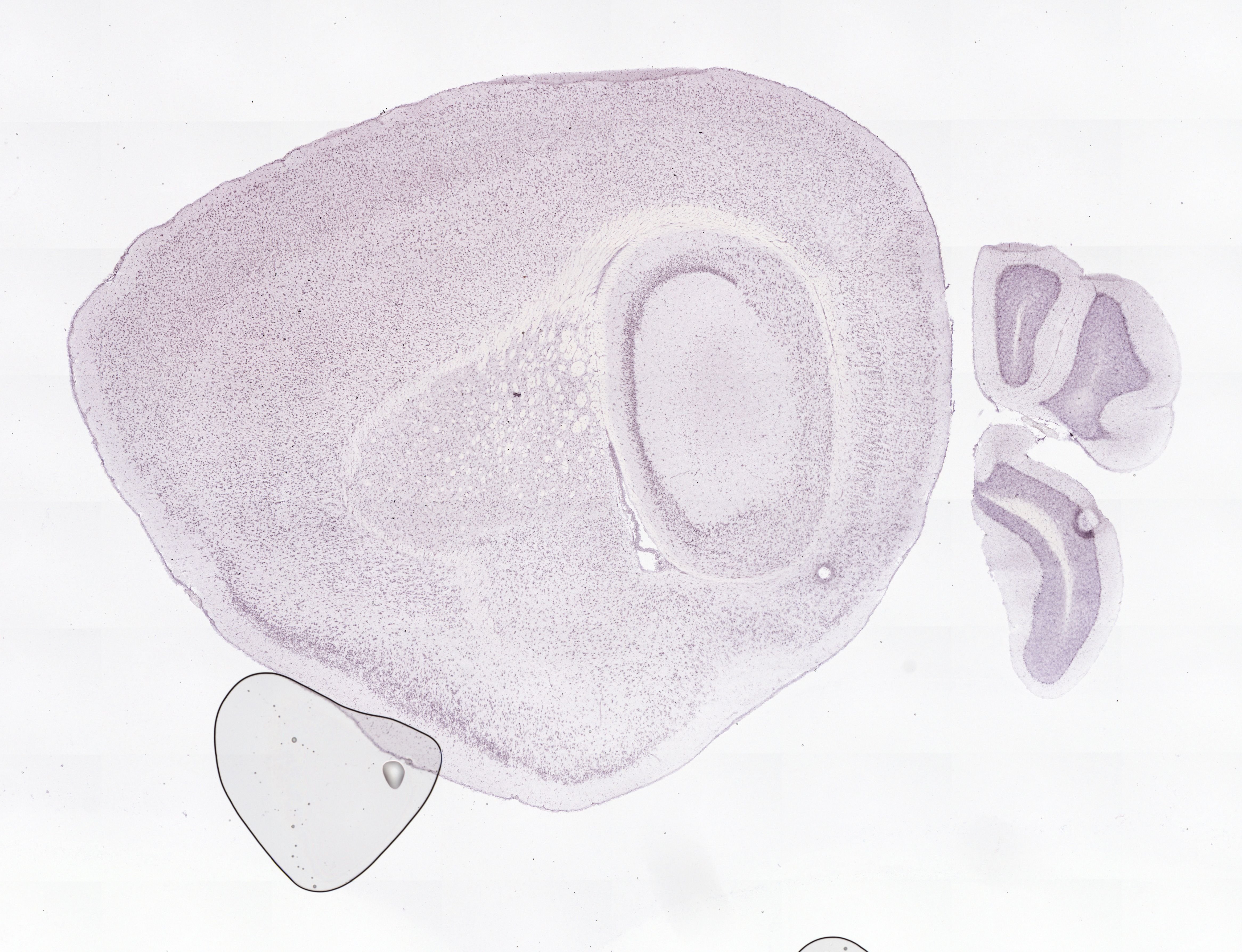 Allen ISH experiment 75985900, image 75863135 -- target region: V (Motor nucleus of trigeminal)