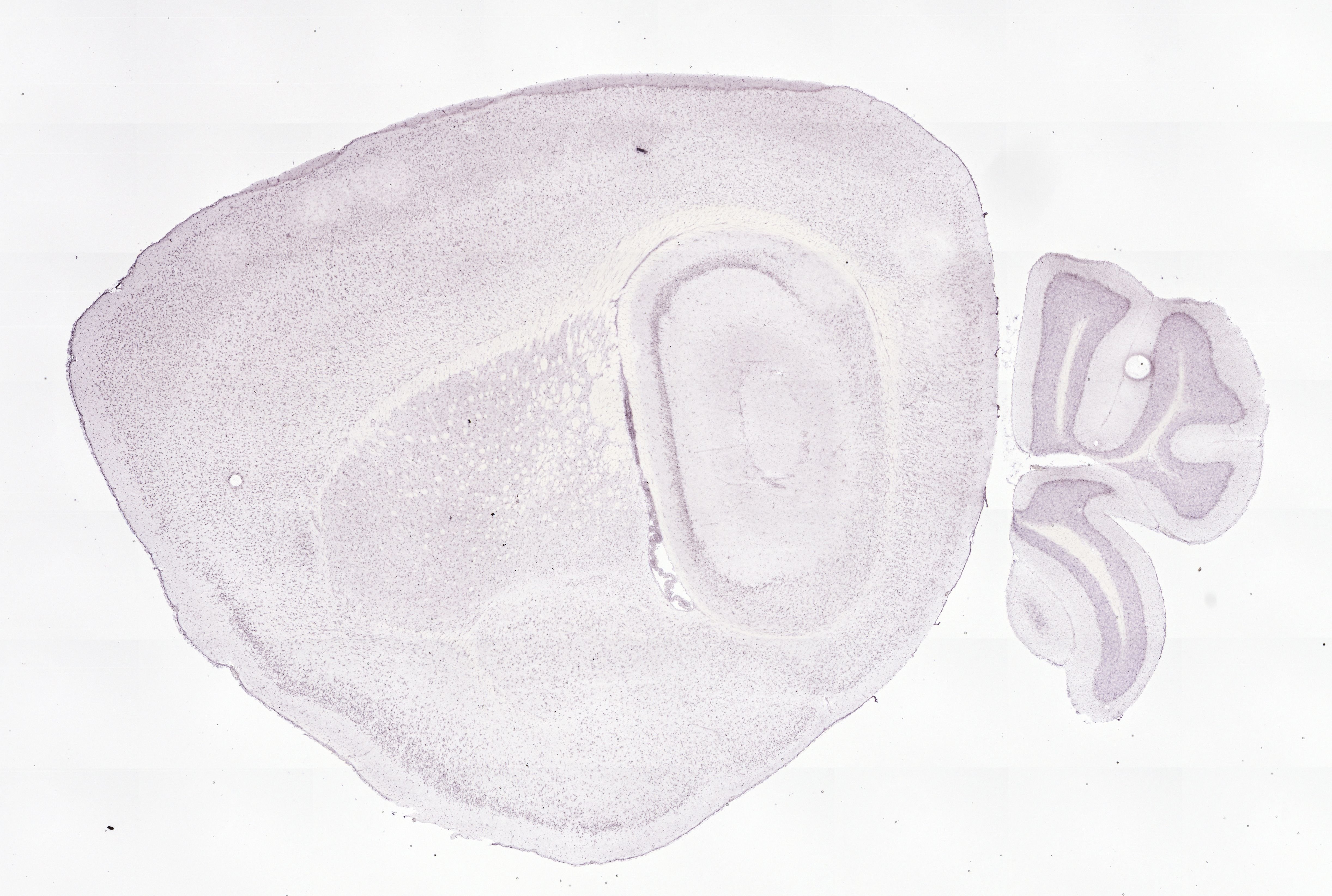 Allen ISH experiment 75985900, image 75863137 -- target region: V (Motor nucleus of trigeminal)