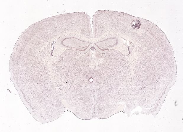 Allen ISH experiment 74511758, image 74397110 -- target region: PMv (Ventral premammillary nucleus)