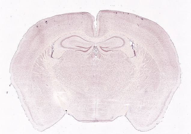 Allen ISH experiment 74511758, image 74397712 -- target region: PMv (Ventral premammillary nucleus)