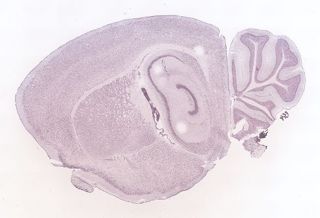Allen ISH experiment 69257570, image 69241400 -- target region: SCO (Subcommissural organ)