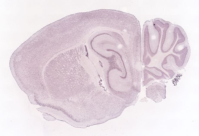 Allen ISH experiment 69257570, image 69241402 -- target region: SCO (Subcommissural organ)