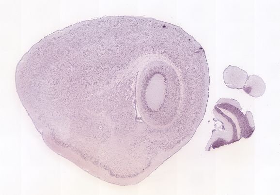 Allen ISH experiment 71325378, image 71206088 -- target region: V (Motor nucleus of trigeminal)