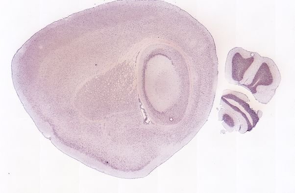 Allen ISH experiment 71325378, image 71206090 -- target region: V (Motor nucleus of trigeminal)
