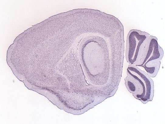 Allen ISH experiment 69863249, image 69883278 -- target region: MH (Medial habenula)