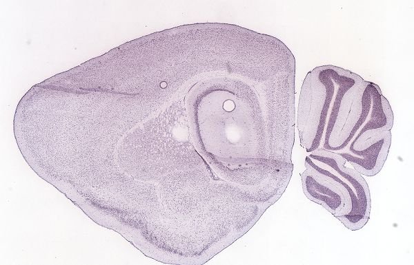 Allen ISH experiment 69863249, image 69883280 -- target region: MH (Medial habenula)