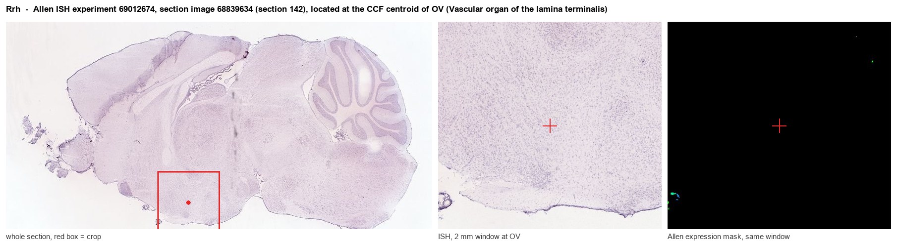 Rrh Allen ISH at the CCF centroid of OV