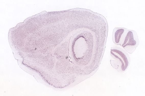 Allen ISH experiment 71487191, image 71290743 -- target region: OV (Vascular organ of the lamina terminalis)
