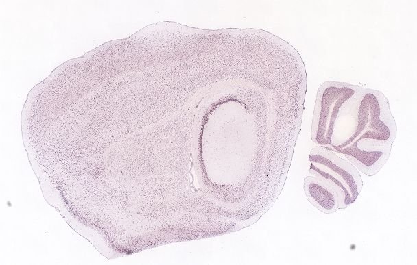 Allen ISH experiment 71487191, image 71290745 -- target region: OV (Vascular organ of the lamina terminalis)