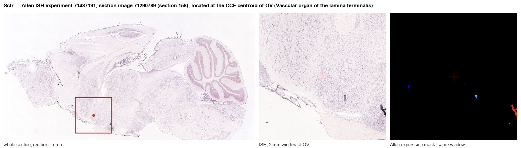 Sctr Allen ISH at the CCF centroid of OV