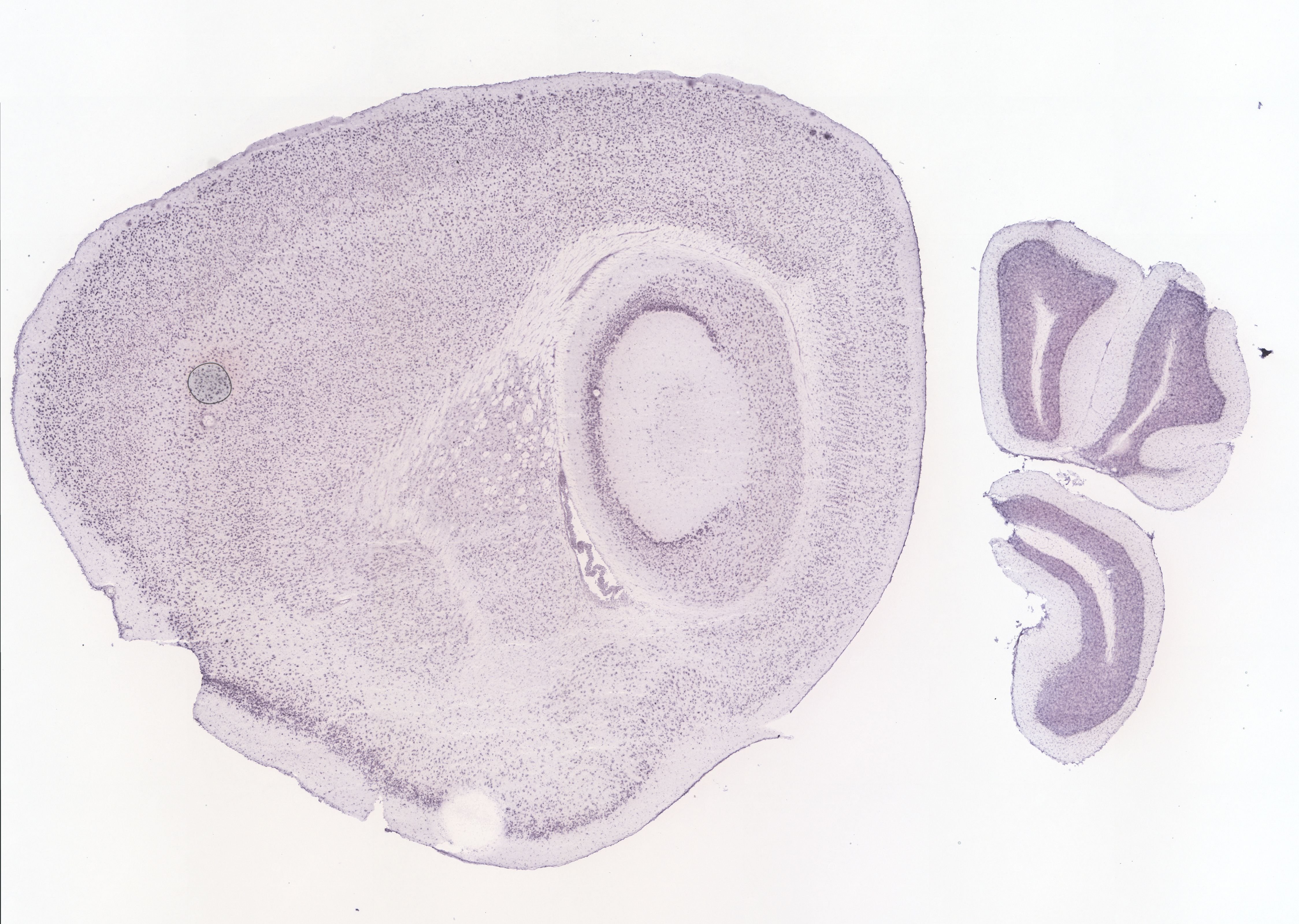 Allen ISH experiment 69873994, image 69826279 -- target region: CEAl (Central amygdalar nucleus, lateral part)