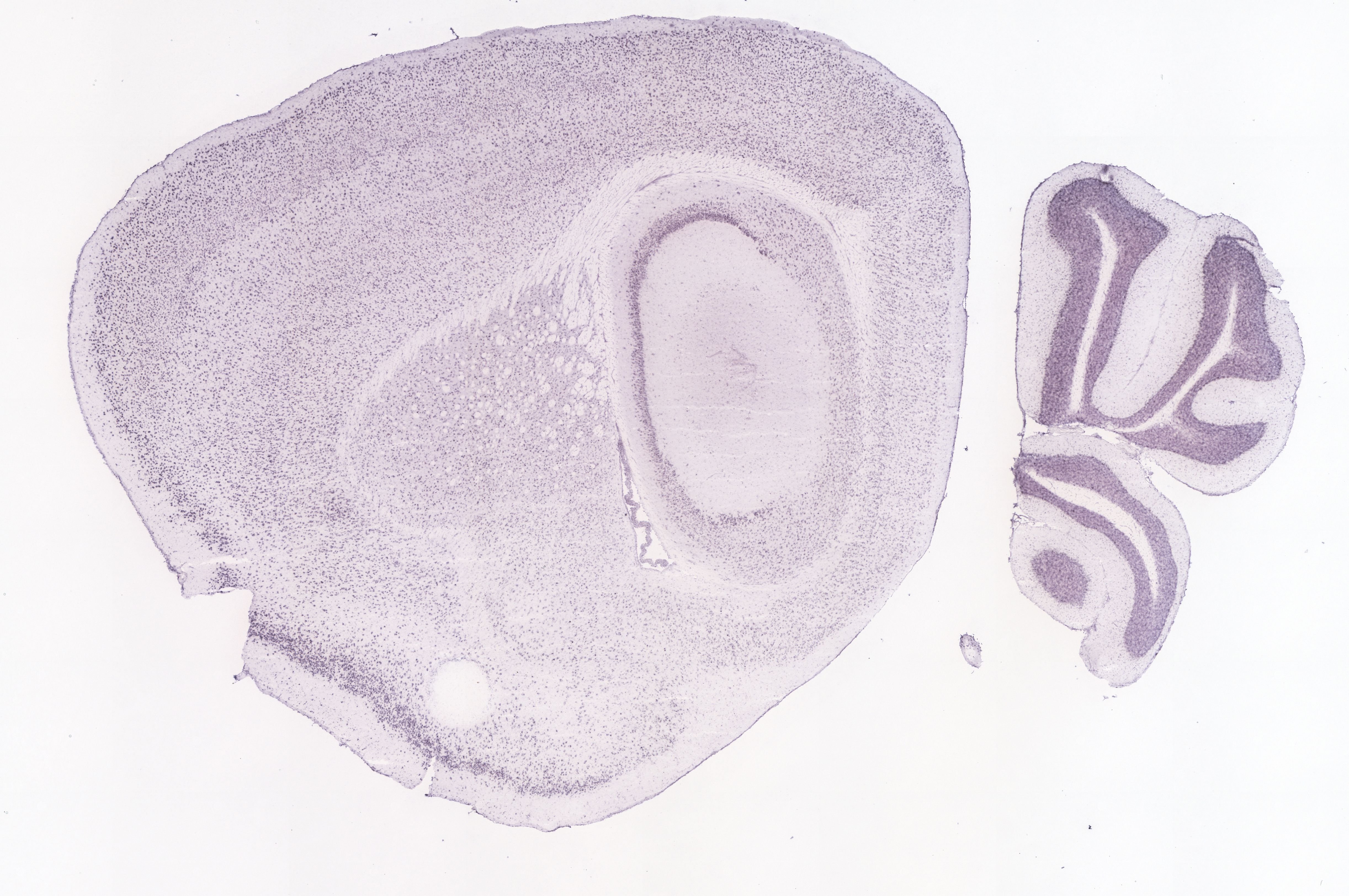 Allen ISH experiment 69873994, image 69826281 -- target region: CEAl (Central amygdalar nucleus, lateral part)