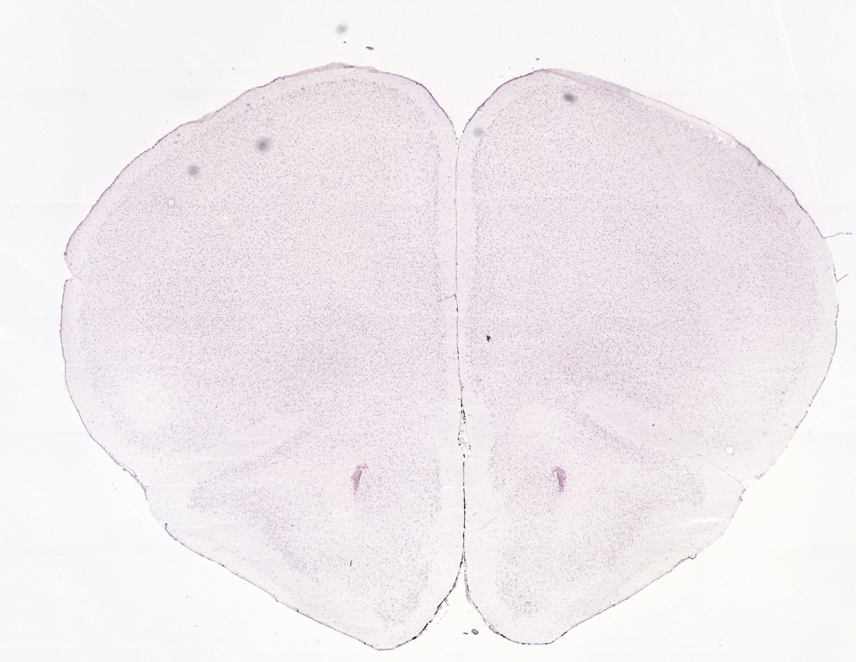 Allen ISH experiment 73615562, image 73526776 -- target region: LC (Locus ceruleus)