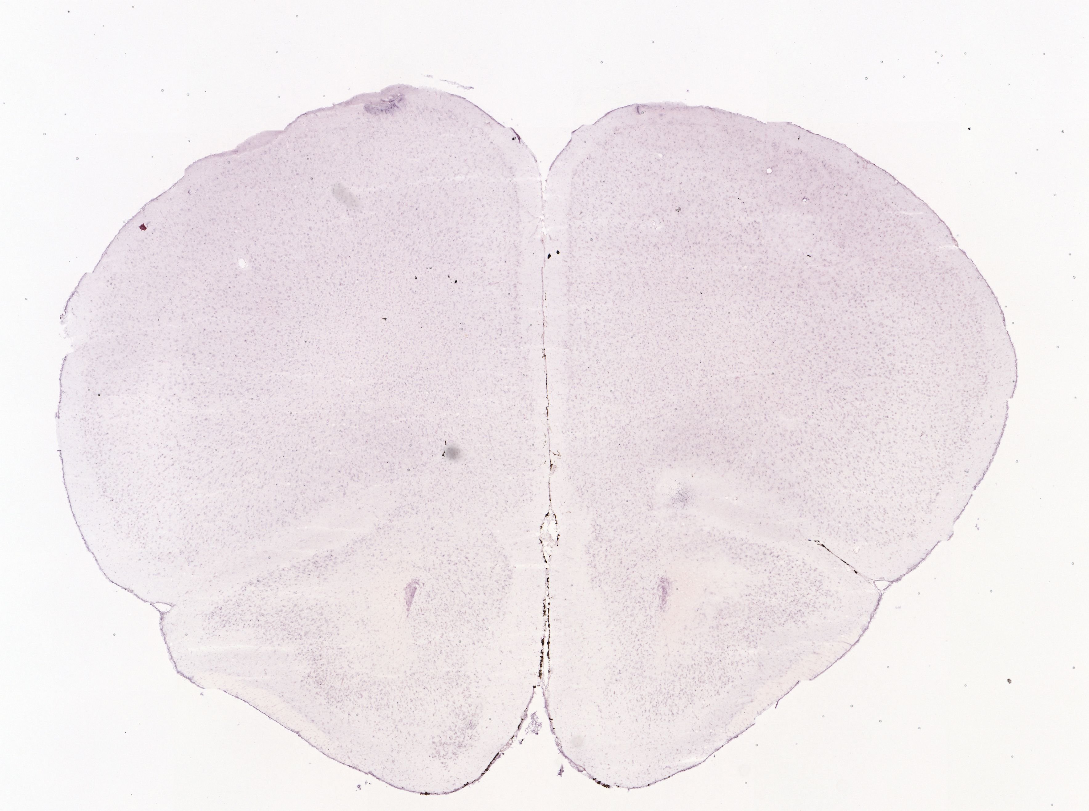 Allen ISH experiment 73615562, image 73527380 -- target region: LC (Locus ceruleus)