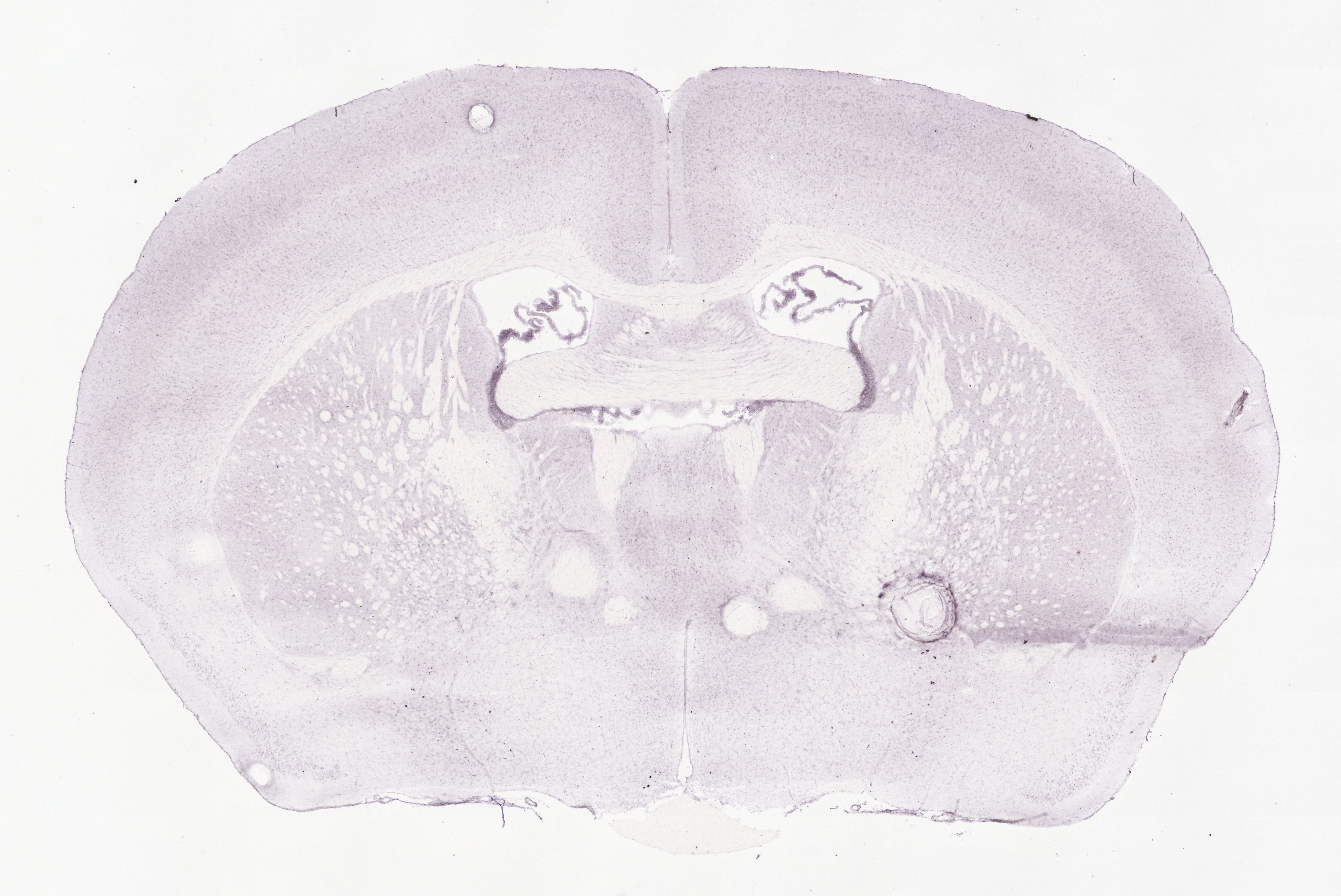 Allen ISH experiment 79591365, image 79605234 -- target region: VTA (Ventral tegmental area)