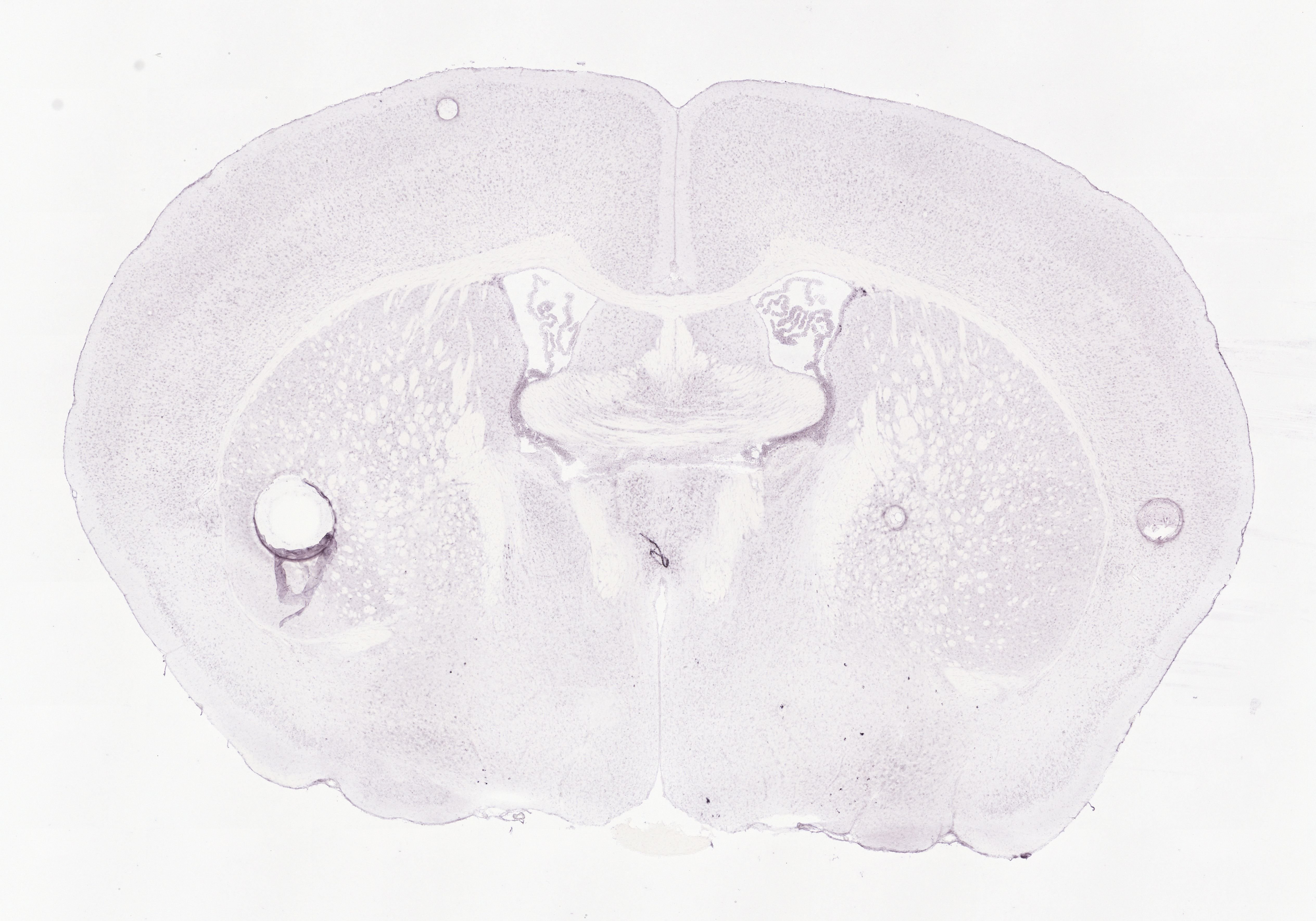 Allen ISH experiment 79591365, image 79605236 -- target region: VTA (Ventral tegmental area)