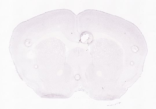 Allen ISH experiment 79591679, image 79627582 -- target region: DR (Dorsal nucleus raphe)