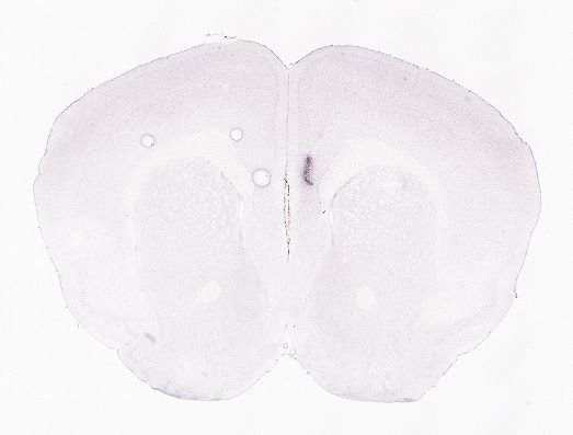 Allen ISH experiment 79591679, image 79627584 -- target region: DR (Dorsal nucleus raphe)