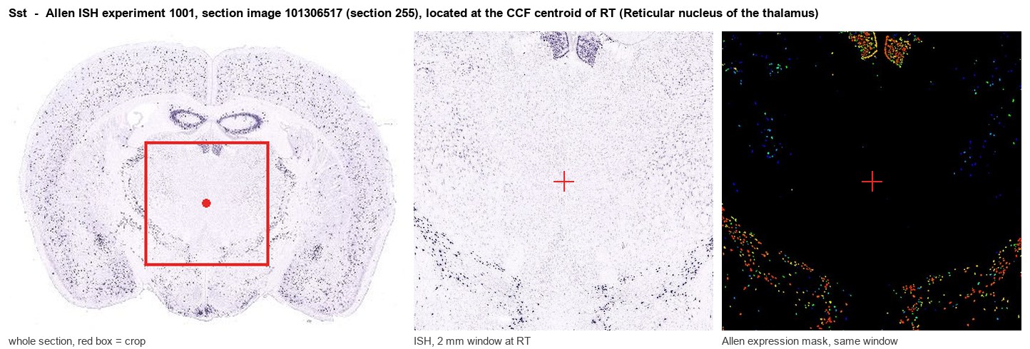 Sst Allen ISH at the CCF centroid of RT