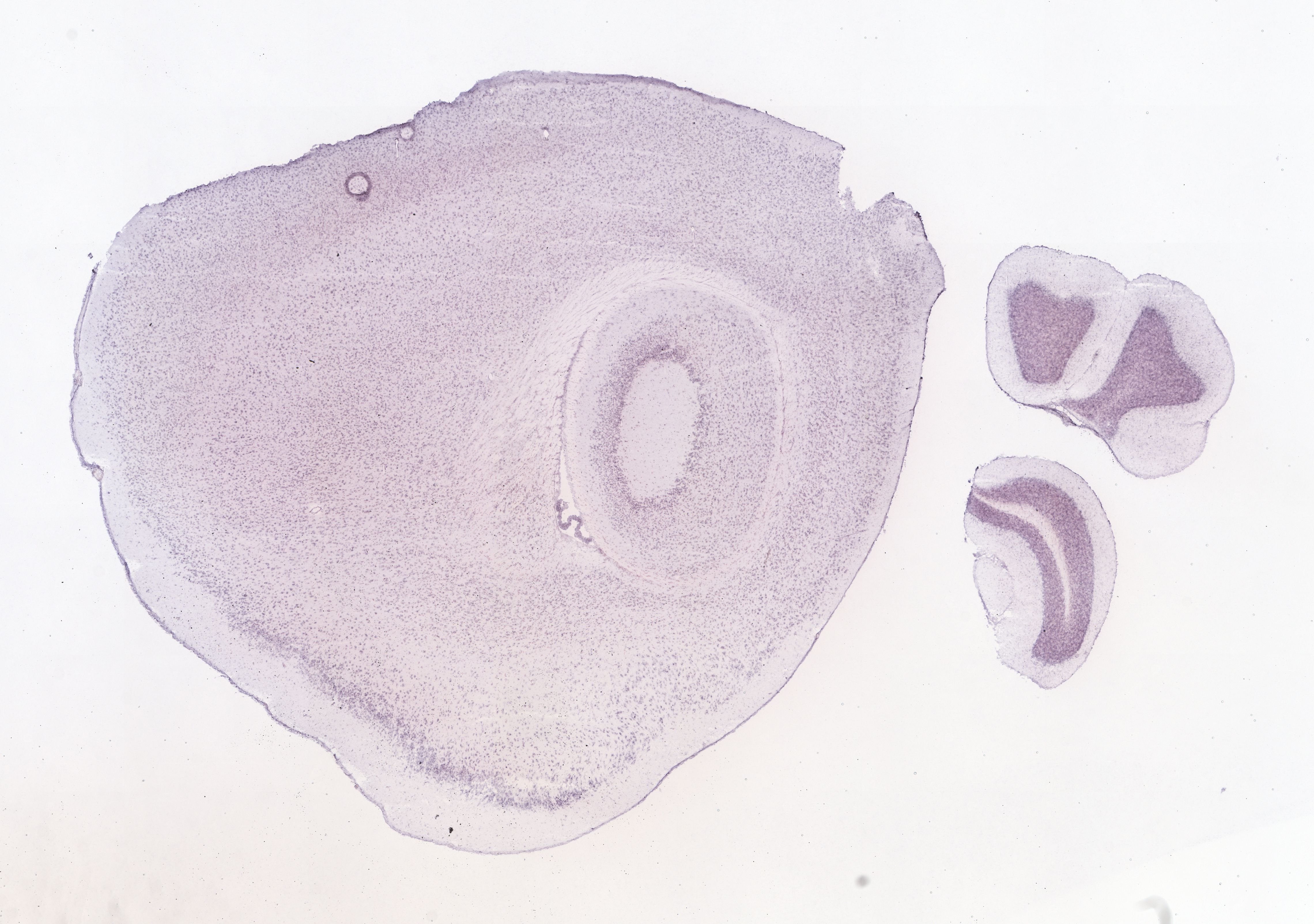 Allen ISH experiment 69981061, image 69899379 -- target region: SCO (Subcommissural organ)