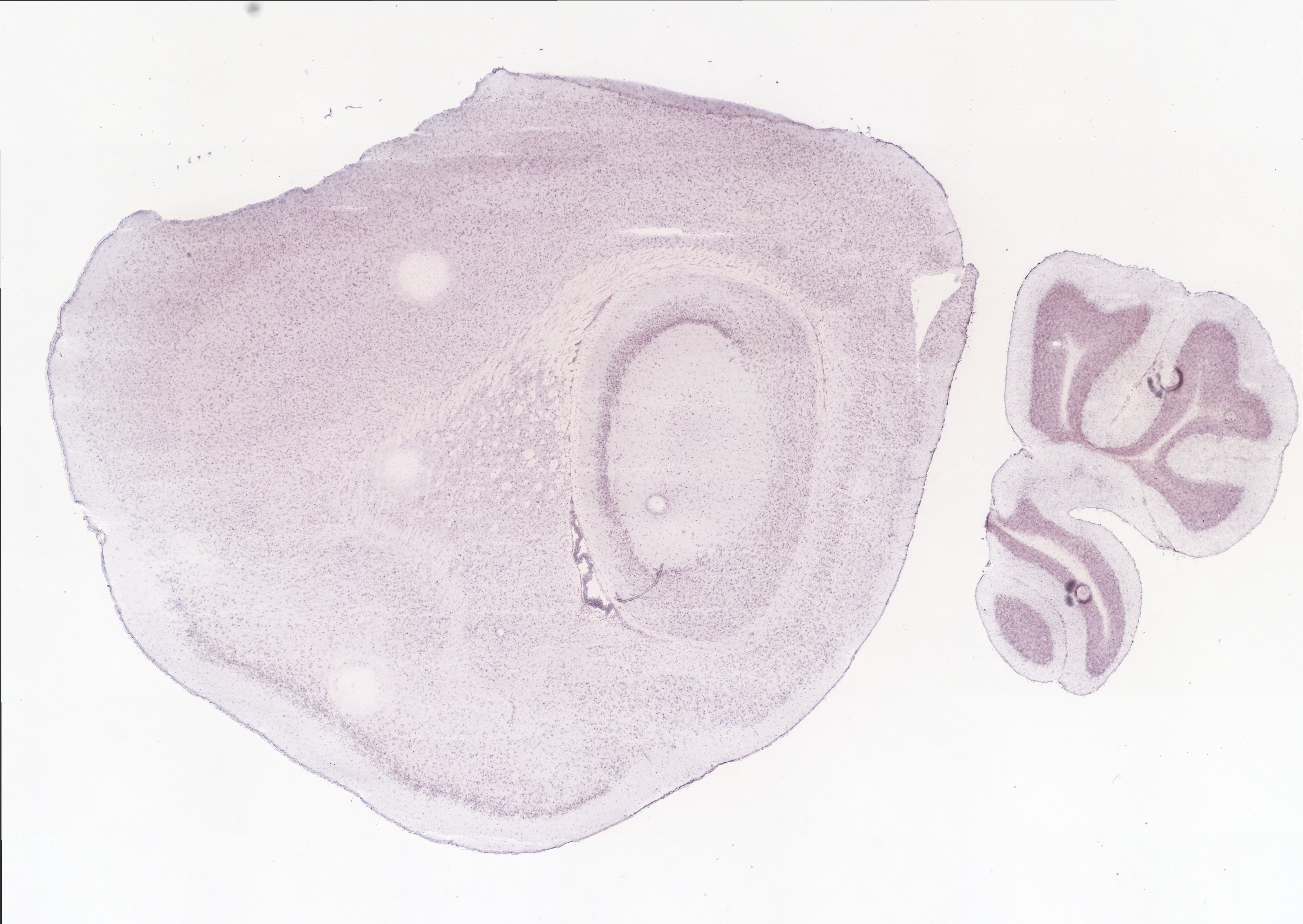 Allen ISH experiment 69981061, image 69899381 -- target region: SCO (Subcommissural organ)