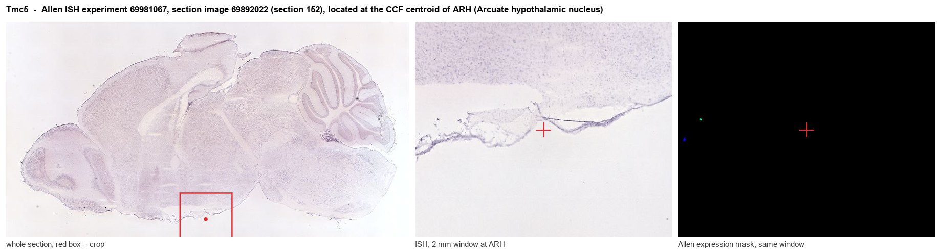 Tmc5 Allen ISH at the CCF centroid of ARH