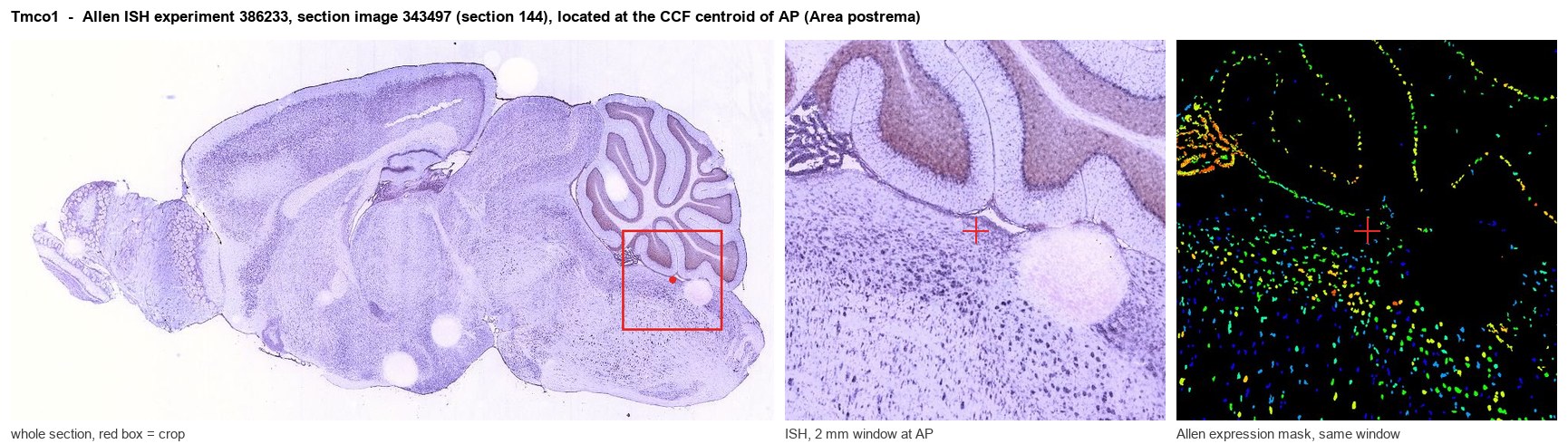Tmco1 Allen ISH at the CCF centroid of AP
