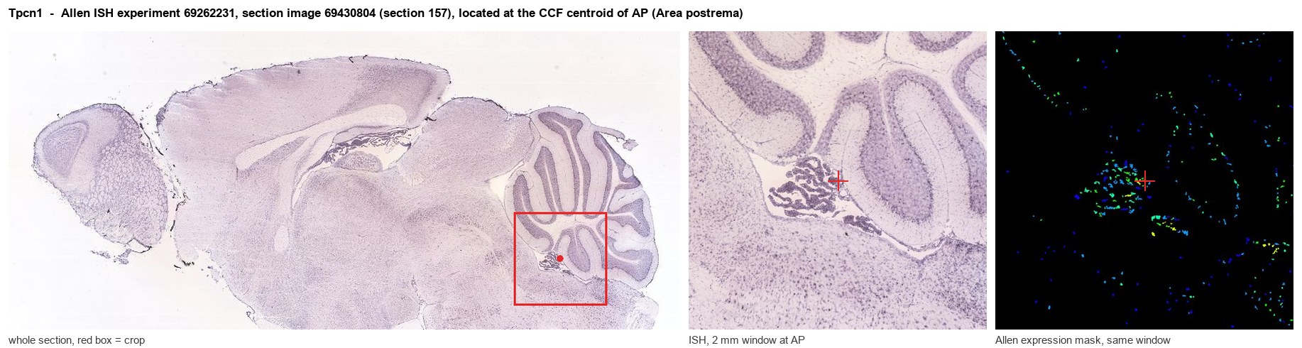 Tpcn1 Allen ISH at the CCF centroid of AP