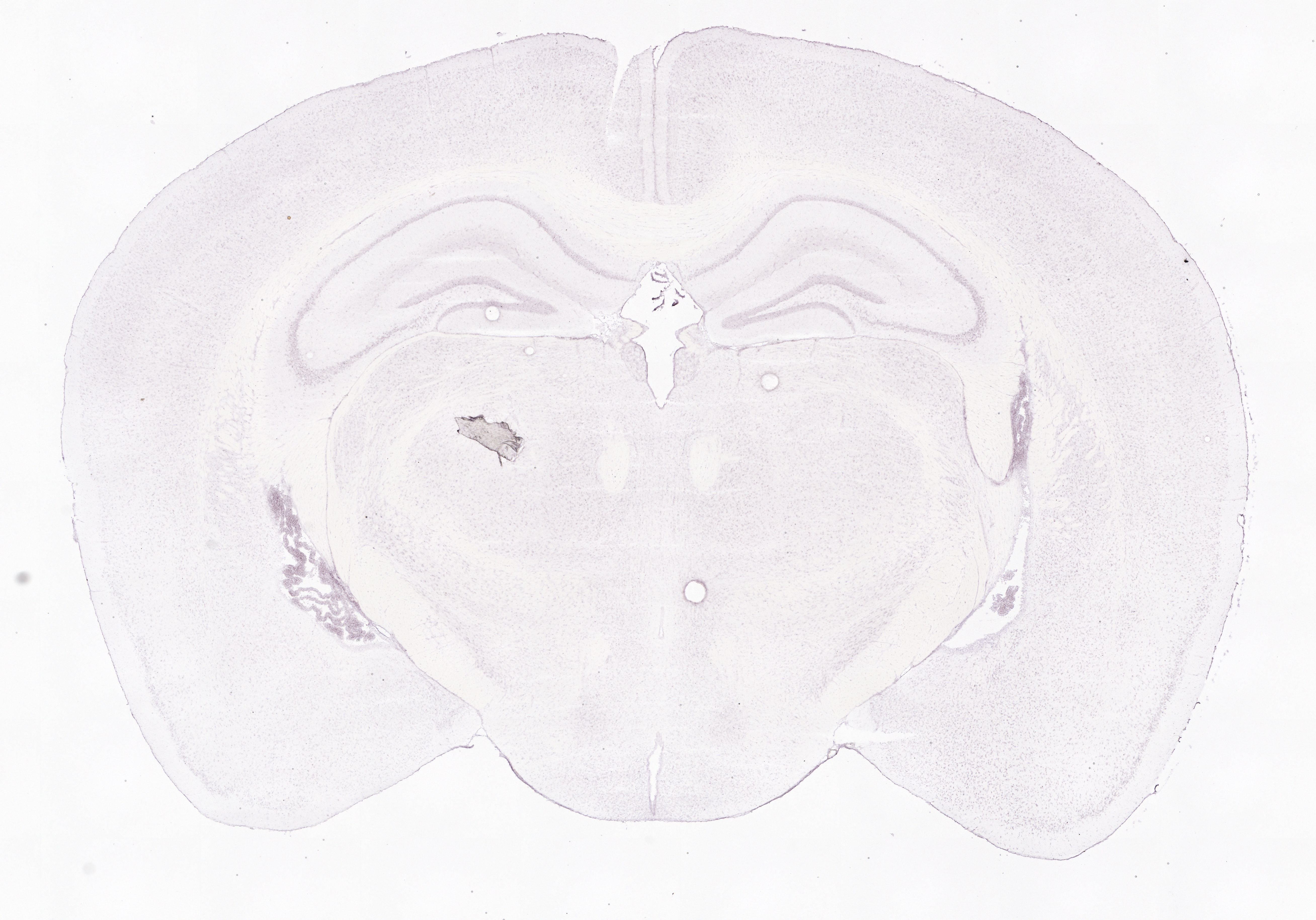Allen ISH experiment 75081002, image 75052688 -- target region: MH (Medial habenula)