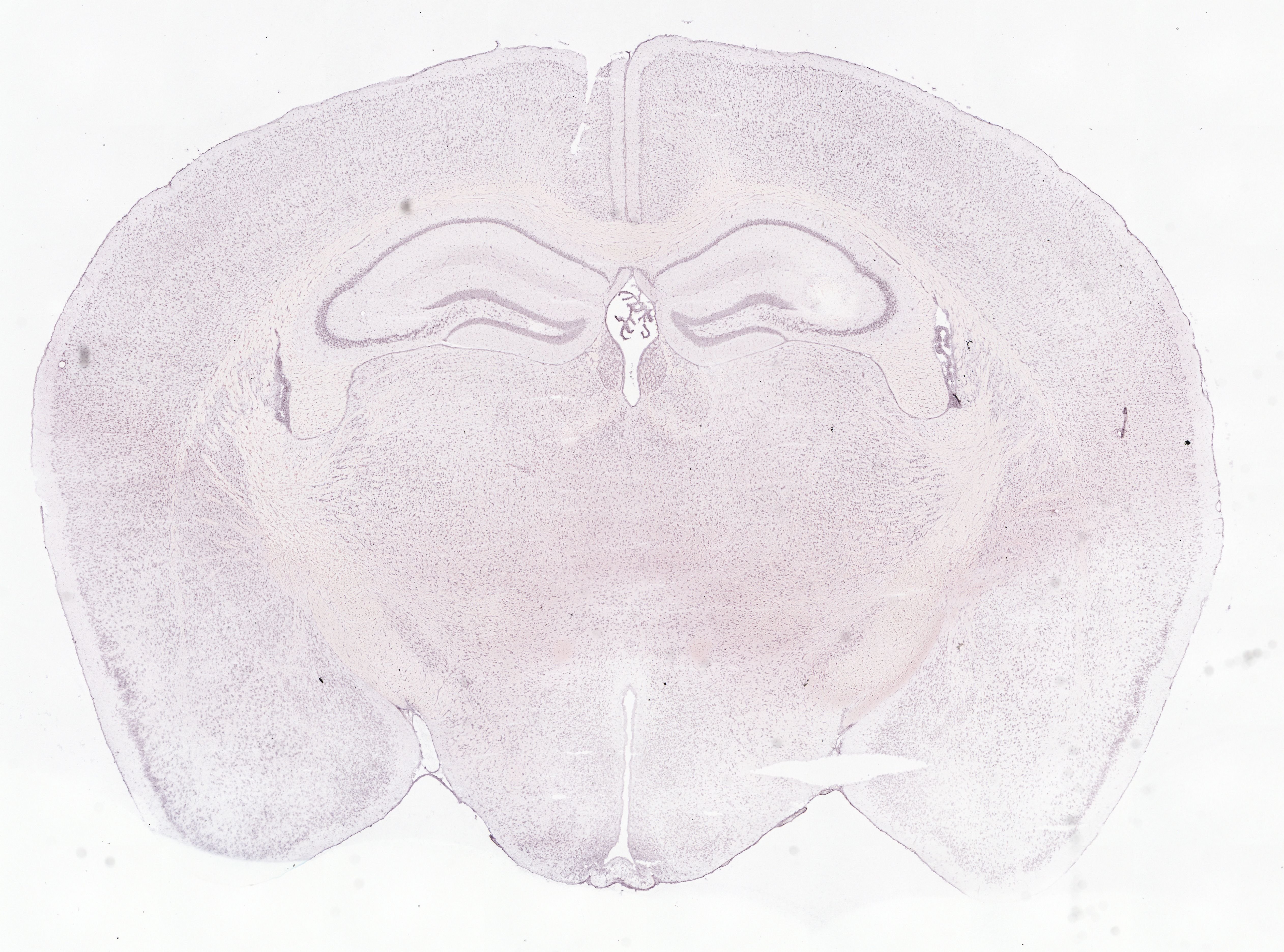 Allen ISH experiment 75081002, image 75052694 -- target region: MH (Medial habenula)