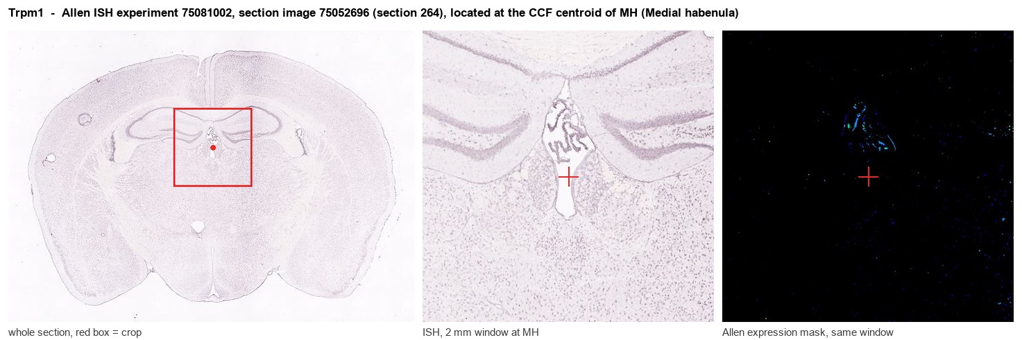 Trpm1 Allen ISH at the CCF centroid of MH