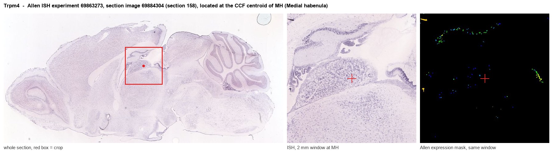 Trpm4 Allen ISH at the CCF centroid of MH