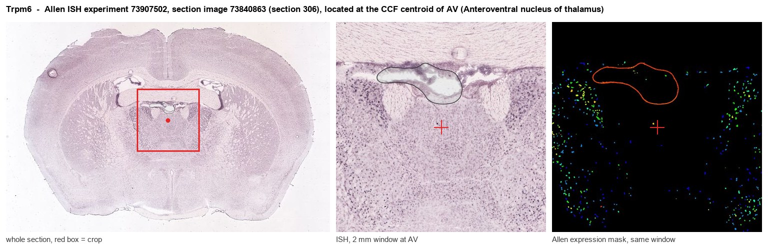 Trpm6 Allen ISH at the CCF centroid of AV
