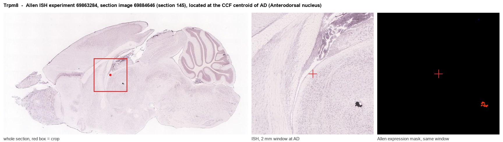 Trpm8 Allen ISH at the CCF centroid of AD