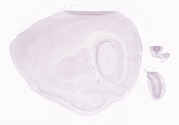 Allen ISH experiment 80471957, image 80444828 -- target region: ME (Median eminence)