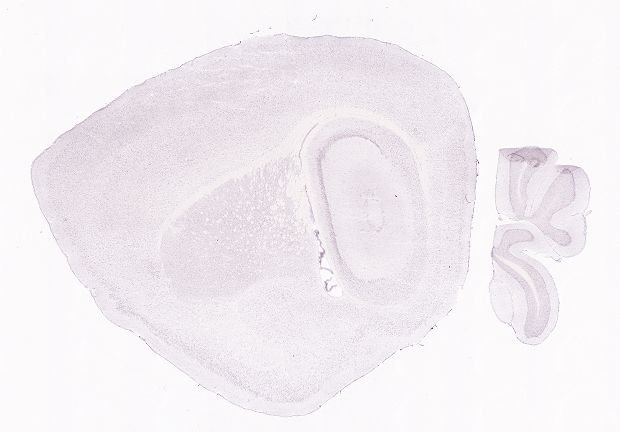 Allen ISH experiment 80471957, image 80444830 -- target region: ME (Median eminence)